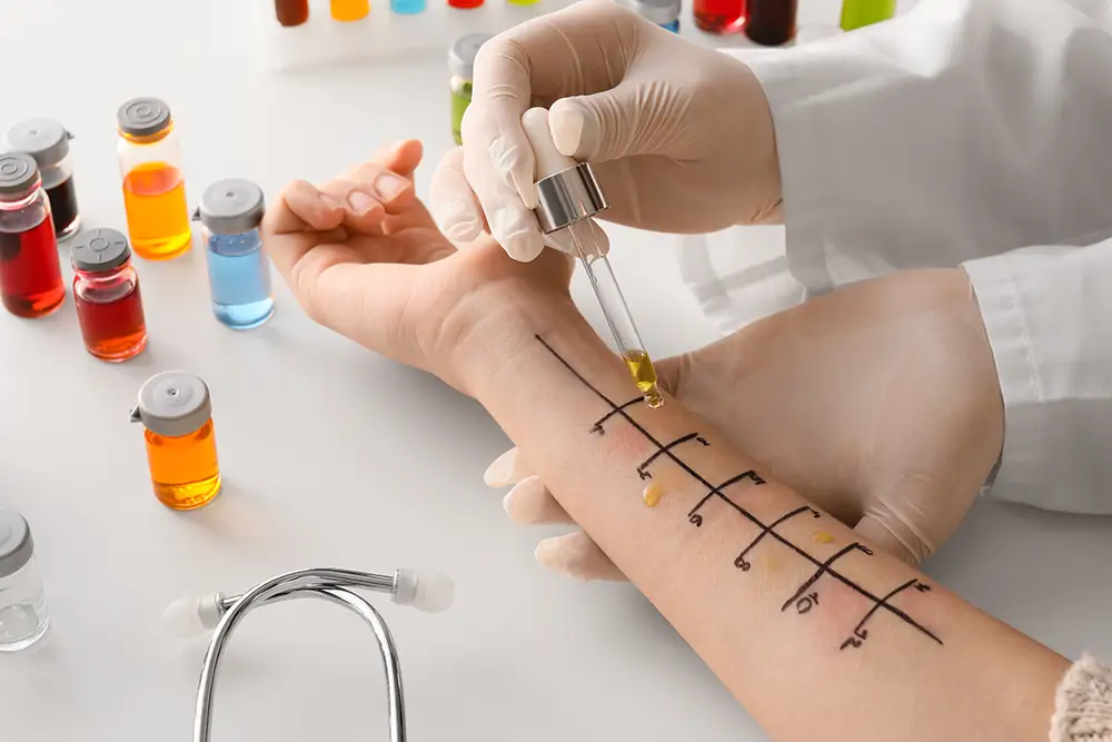 A doctor administering an allergy test